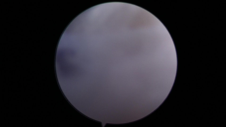 Anterior cruciate ligament repair
